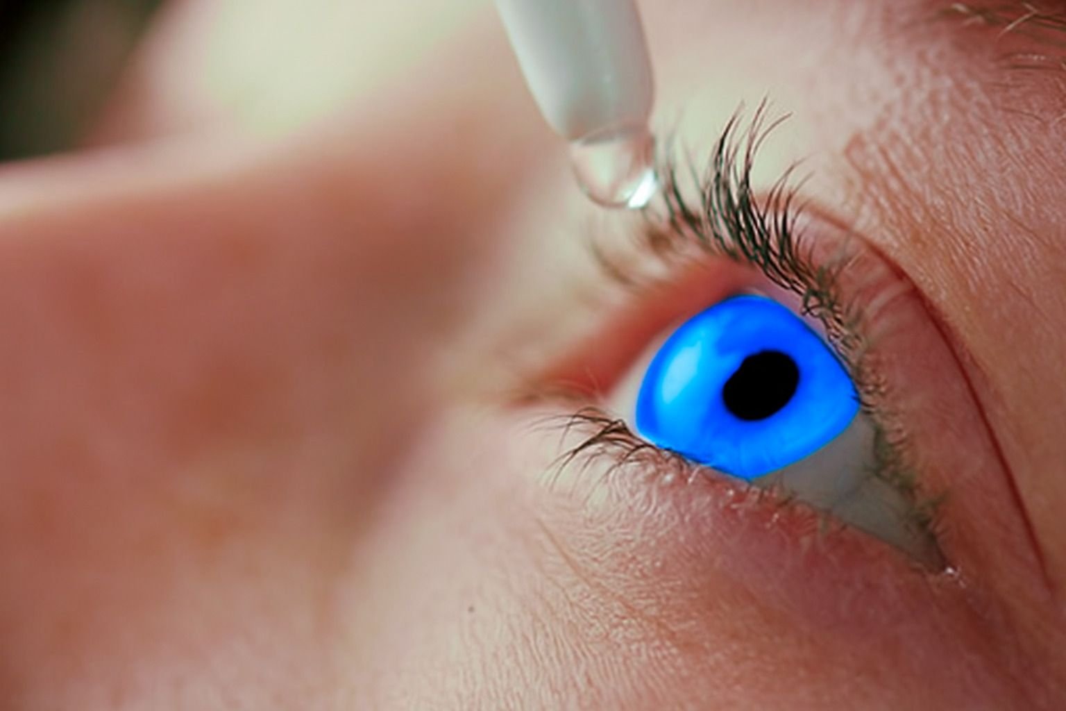 Overall eye care and ancient practices Challenge Surgery Governance in cataract treatment. WLT Report