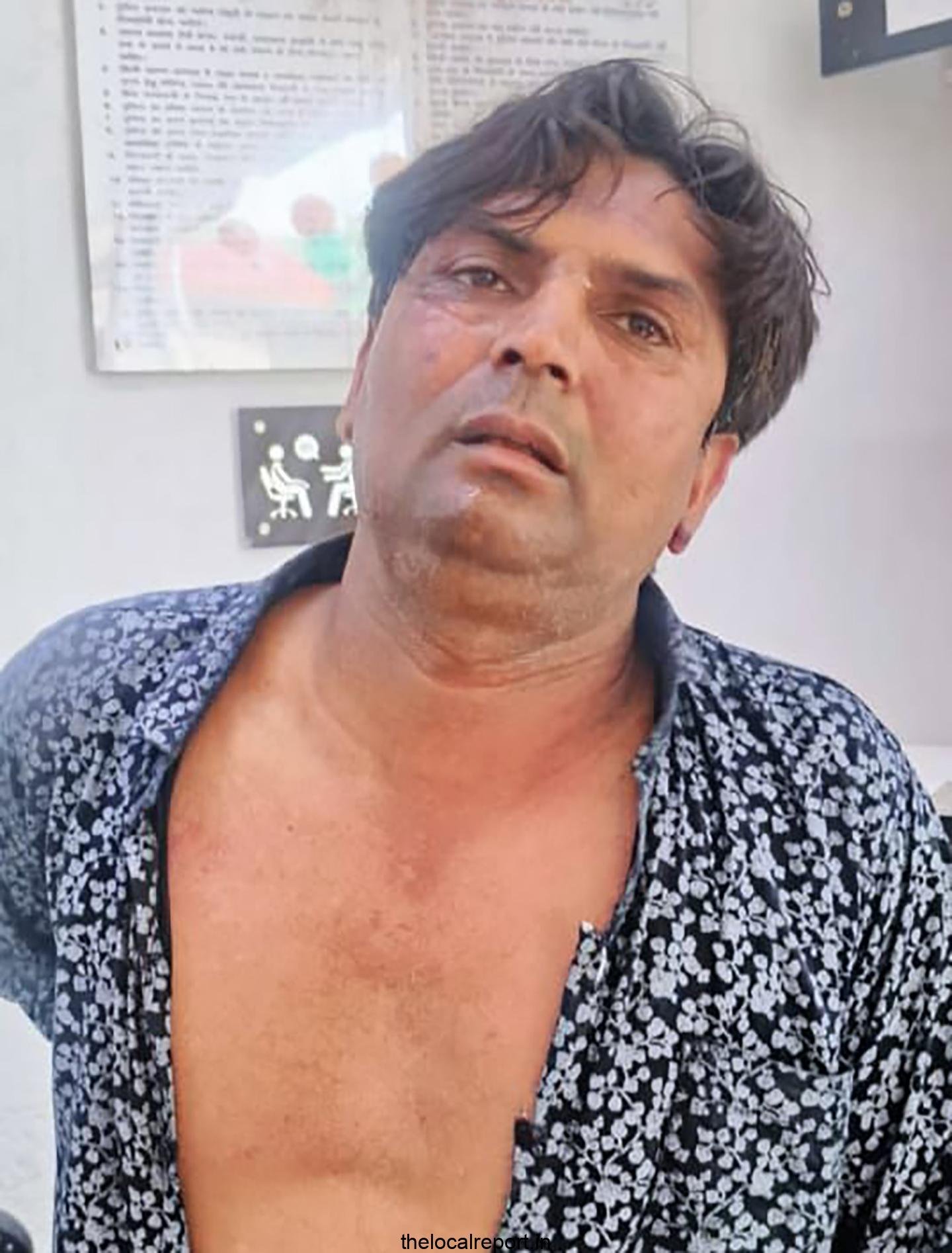 CM Rekha Gupta Attack: Delhi Court directed the police to provide FIR copy to the accused