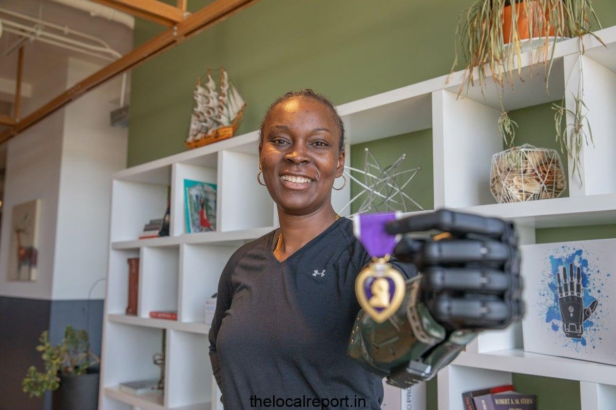 American experienced for the first time to obtain a new bionic arm designed by the UK firm