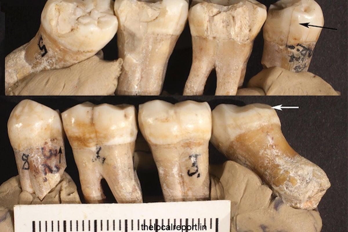 Large fossil studies challenge the idea of ​​human development for a long time