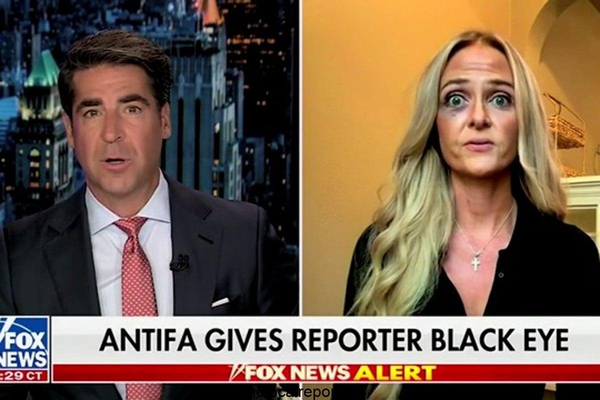 Right-wing journalist says that 'Antifa-Bedd' Portland protector gave him a black eye