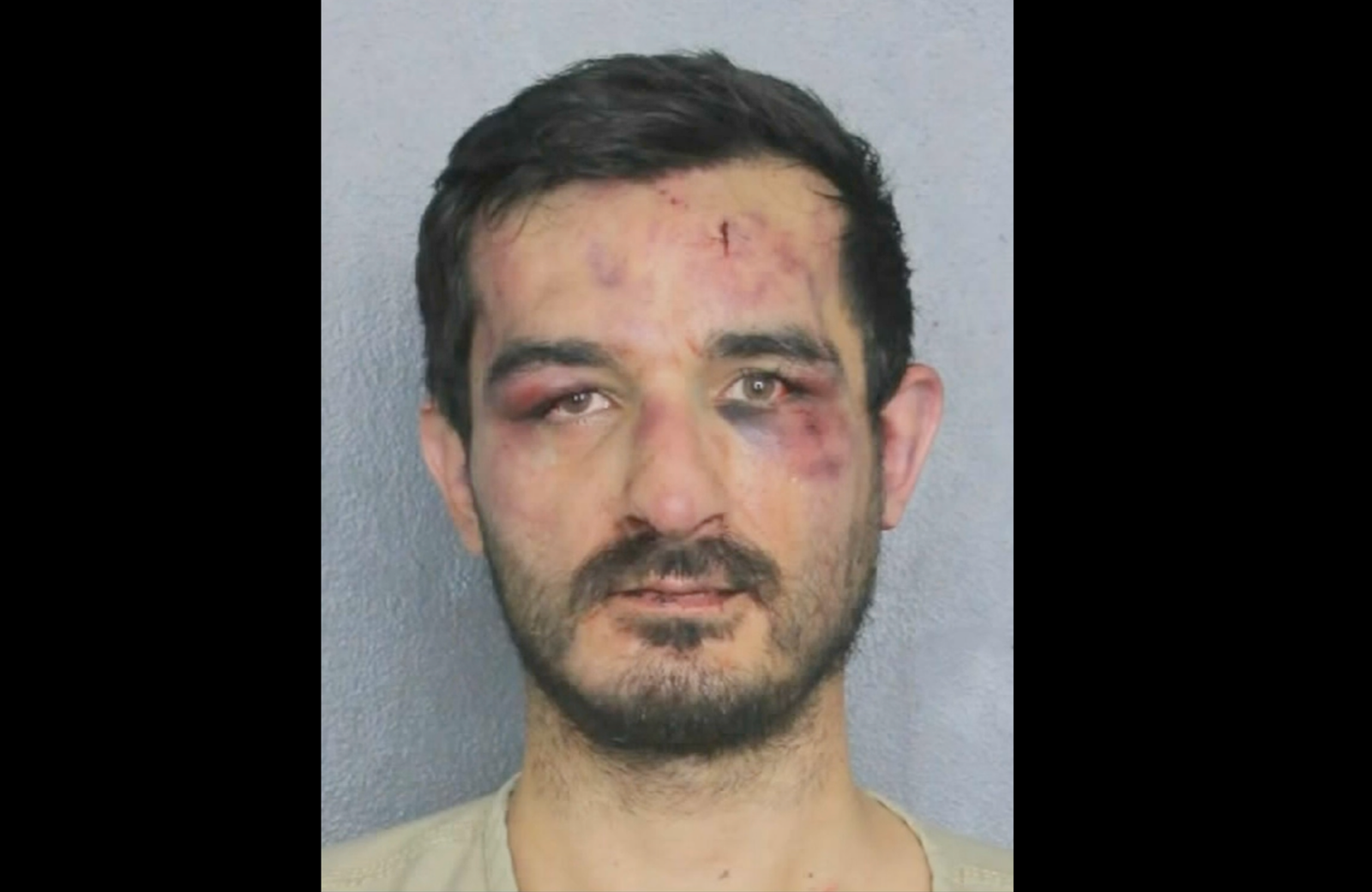 Caresani said that he was drinking alcohol and accidentally went to the wrong house