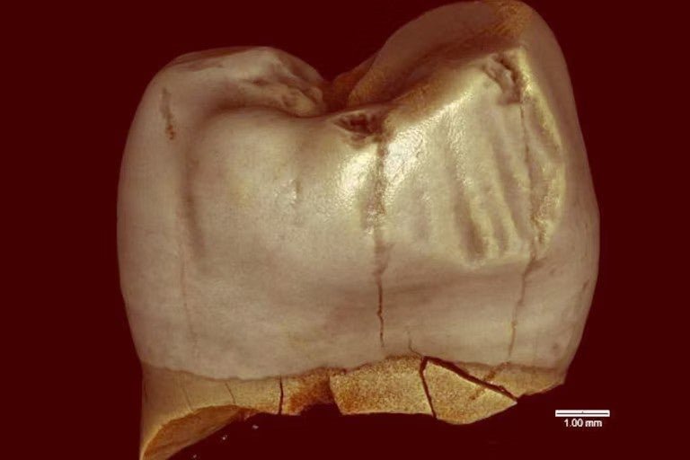 A niedarthal teeth