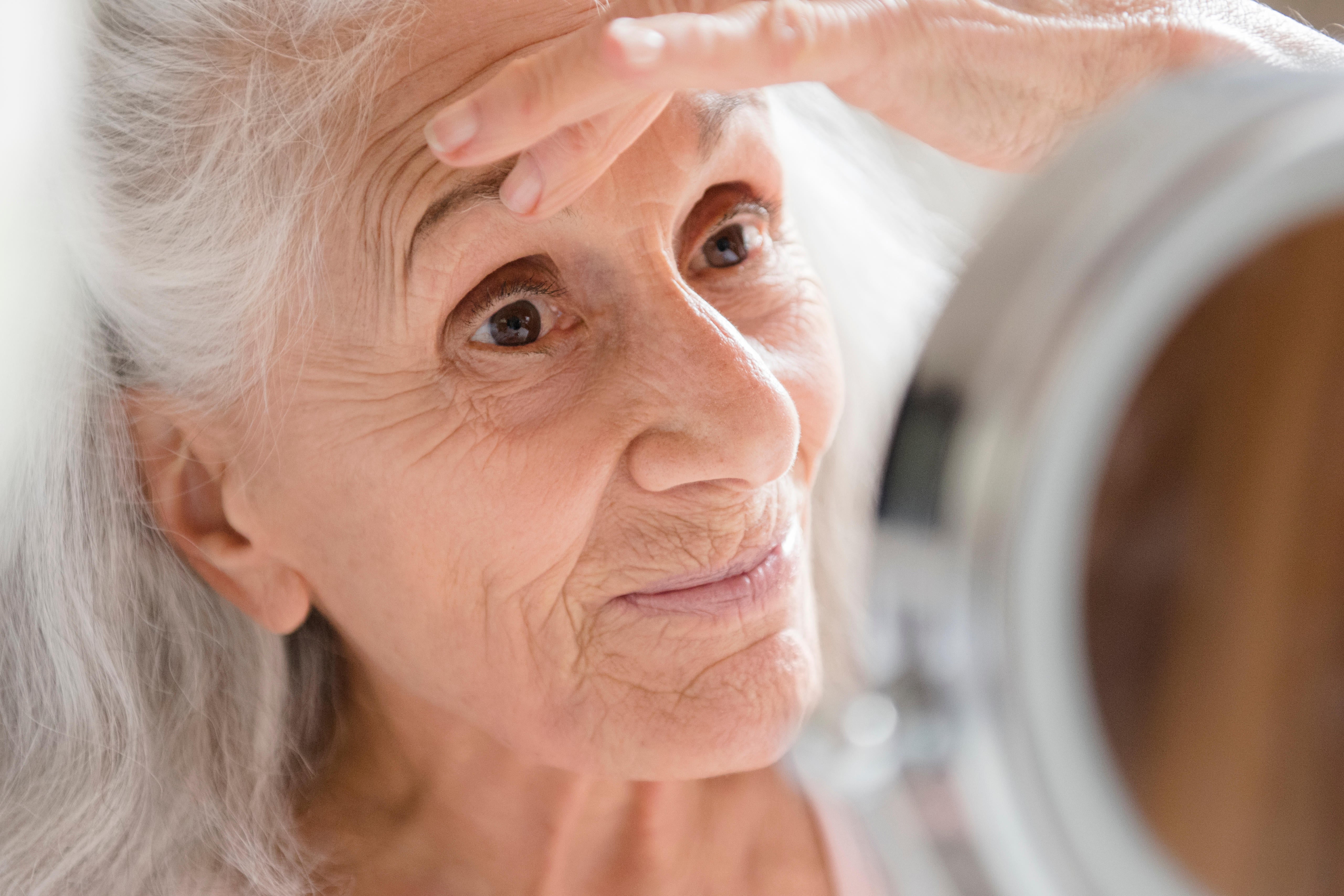 Wrinkles around eyes linked to dementia, scientists warn