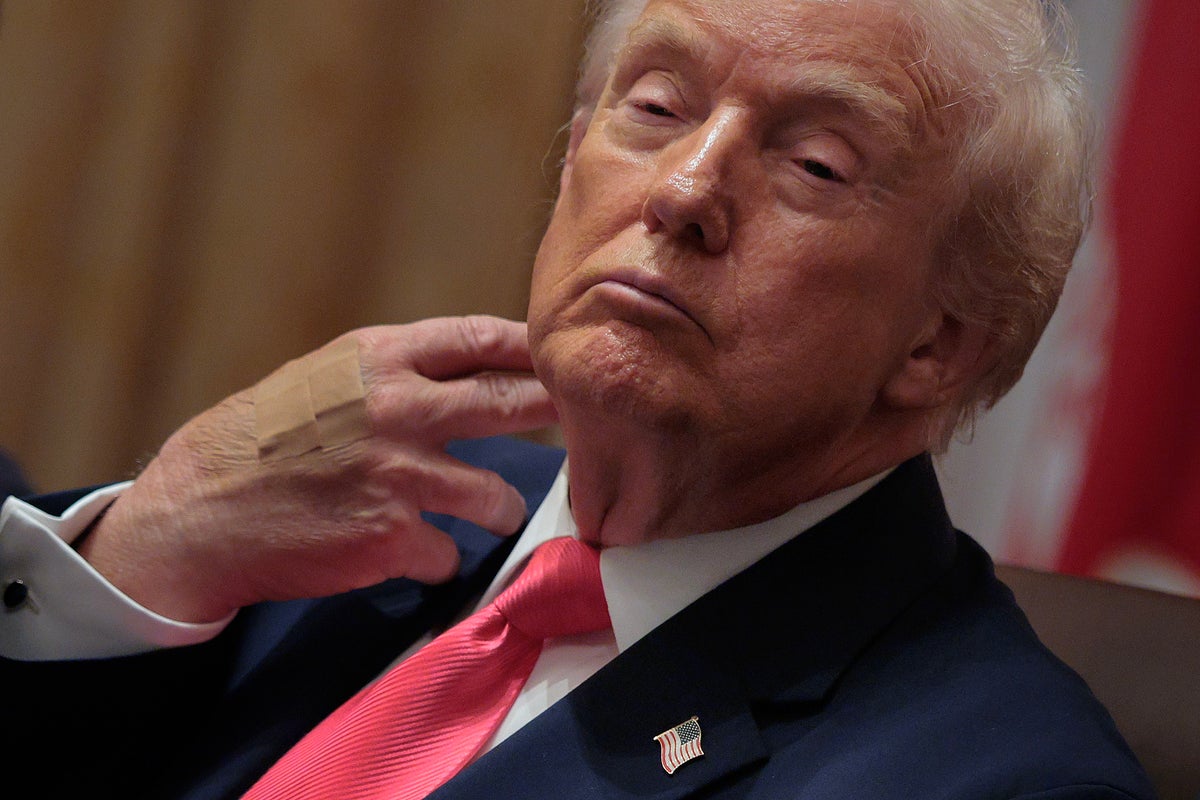 Dick Cheney's heart expert says Trump taking aspirin 'makes no sense'