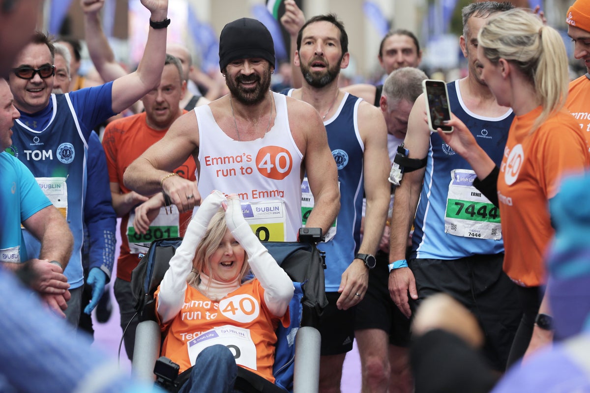 Emma Fogarty discusses friendship with Colin Farrell and her rare genetic disorder