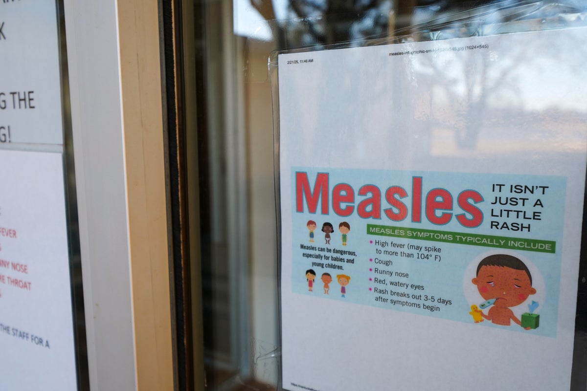 Measles outbreak in South Carolina increases by nearly 100 cases, spreading to North Carolina and Ohio