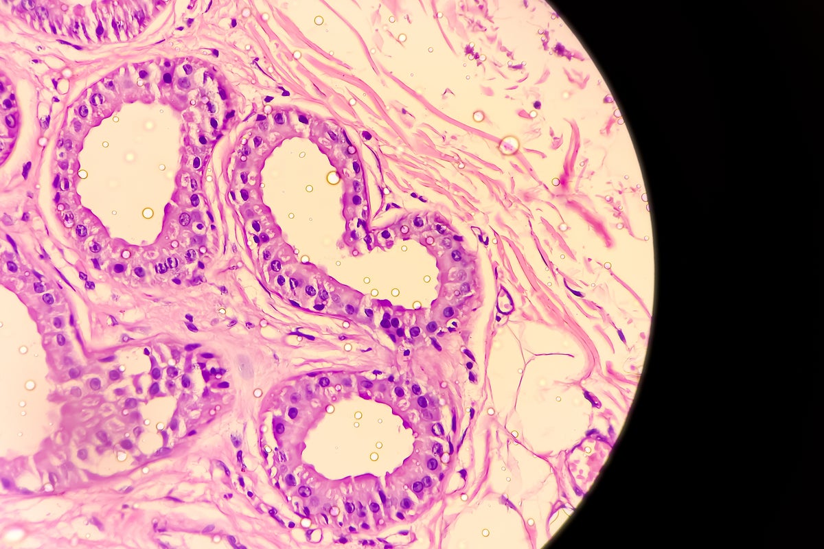 Painful skin conditions hidden in plain sight